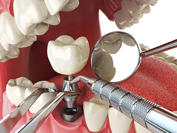 Best Weekend Emergency Dentist in Rhinelander, WI